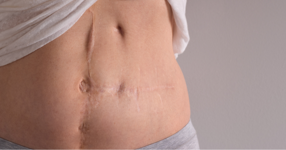 Narbenheilung Limburg